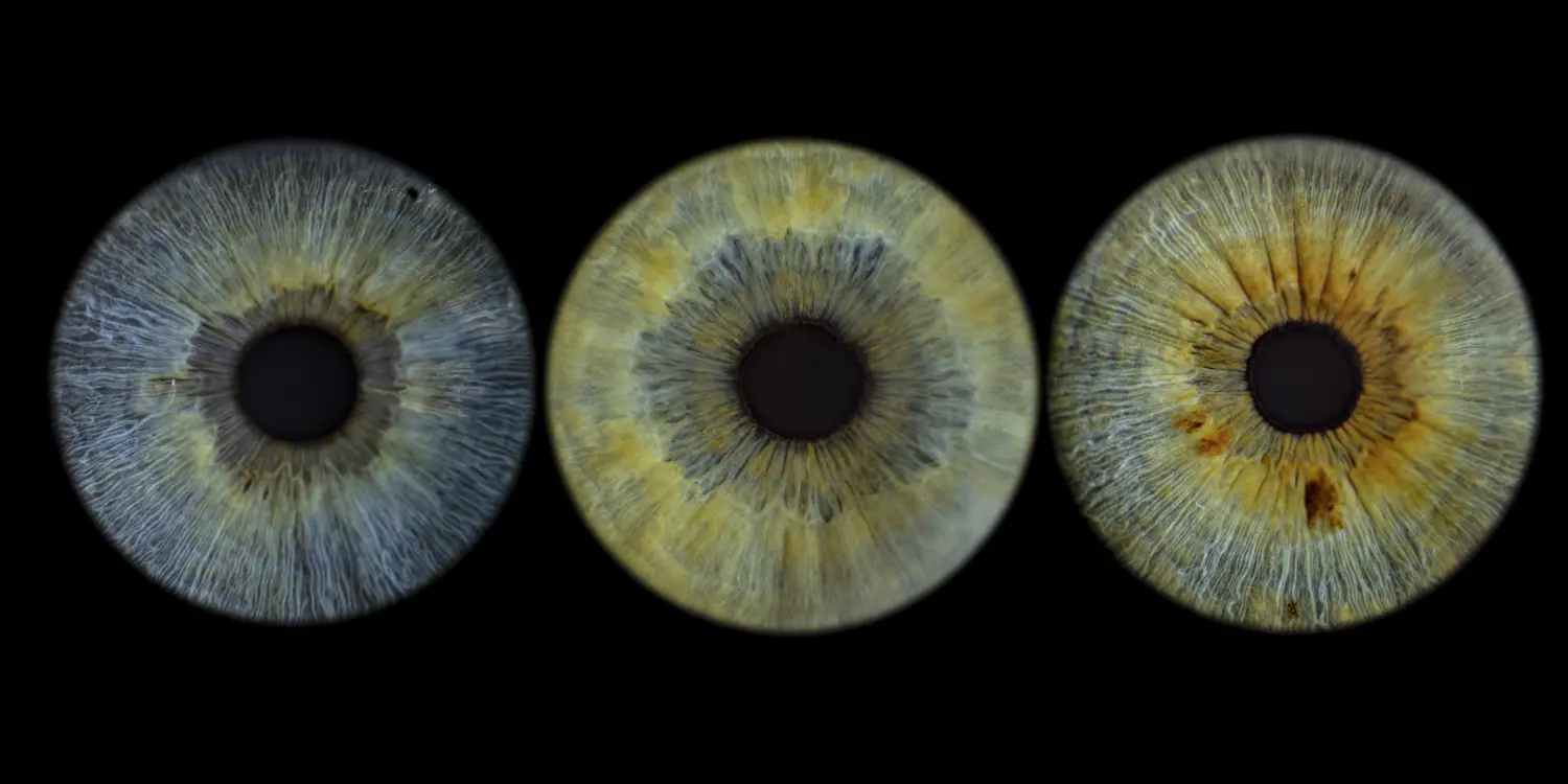 Irisfotografie von Vivid Visions